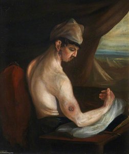 The Wounded Following The Battle Of Corunna Musket Ball Wound Of Humerus — Charles Bell