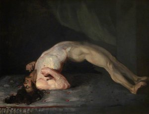 The Wounded Following The Battle Of Corunna Tetanus Following Gunshot Wounds — Charles Bell
