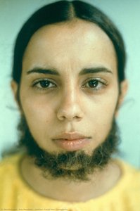 Untitled (facial Hair Transplants) — Ana Mendieta