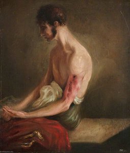 The Wounded Following The Battle Of Corunna Gunshot Fracture Of Shaft Of Humerus — Charles Bell
