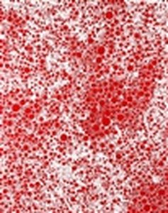 Beyond The End Of The Century — Yayoi Kusama