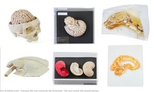 Do You Know The Plastination? — Parque De Las Ciencias De Granada