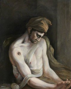 The Wounded Following The Battle Of Corunna Gunshot Wound Of Humerus — Charles Bell