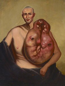 Case No.5111 — Guan Qiaochang Lamqua