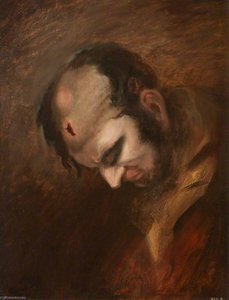 The Wounded Following The Battle Of Corunna Musket Ball Wound Of Head — Charles Bell