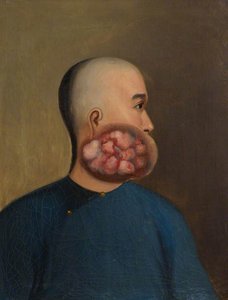 Case No.1675 — Guan Qiaochang Lamqua