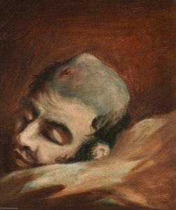 The Wounded Following The Battle Of Corunna Bullet Wound Of Skull — Charles Bell